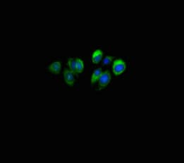 SLURP1 / ARS / MDM Antibody