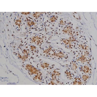 MAPT / Tau Antibody (phospho-Ser396)