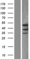STRADA / LYK5 Protein (Over-Expression Lysate Myc-DDK (Flag))