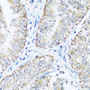 Polyclonal Rabbit anti-Human ATP5I Antibody (IHC, IF)