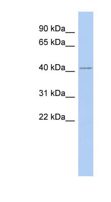 LMNTD1 / IFLTD1 Antibody (C-Terminus)