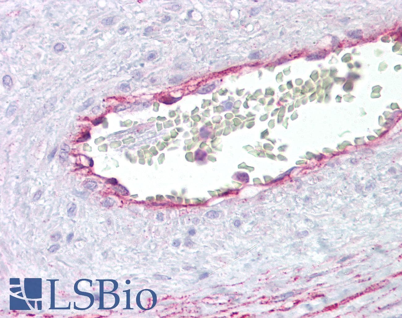 IHC-plus™ ANXA2 / Annexin A2 Antibody (aa19-49)