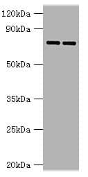 GUSB / Beta Glucuronidase Antibody (aa382-651)