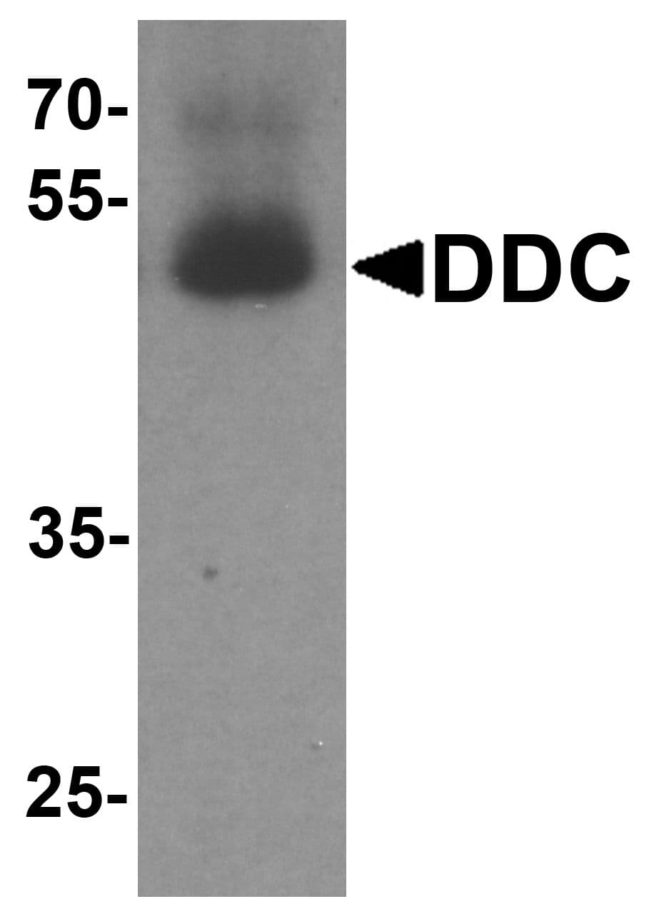 PathPlus™ Polyclonal Rabbit anti-Human DDC / DOPA Decarboxylase Antibody (IHC, IF, WB)