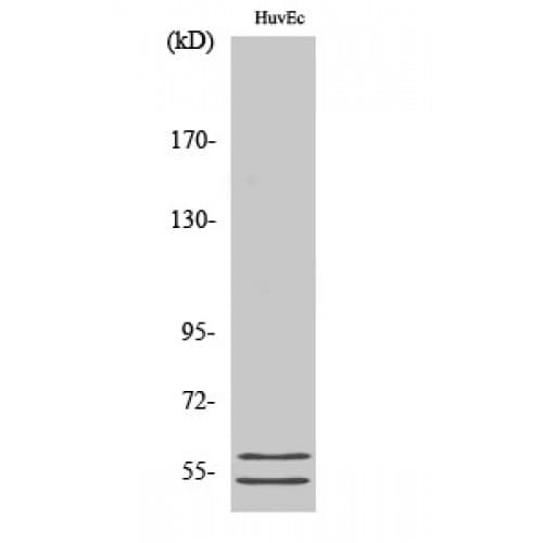 GBA3 / CBG Antibody (260-340 aa, Internal)
