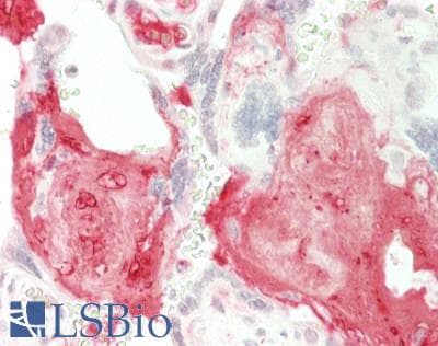 IHC-plus™ CTSD / Cathepsin D Antibody (aa 67-403)