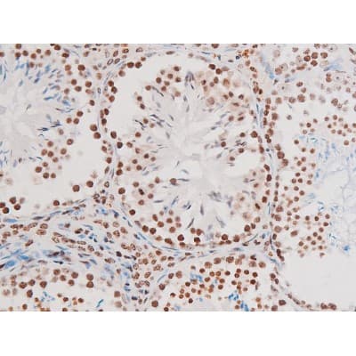 Polyclonal Rabbit anti-Human RELA / NFKB p65 Antibody (phospho-Thr435, IHC, IF, WB)