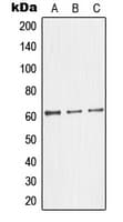 Polyclonal Rabbit anti-Human GK2 / Glycerol Kinase 2 Antibody (Internal, IF, WB)