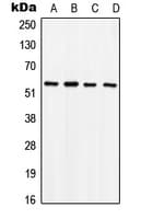 Polyclonal Rabbit anti-Human SOX9 Antibody (phospho-Ser181, WB)