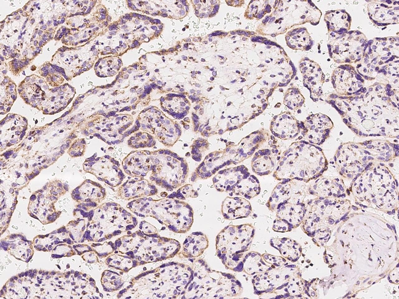 Polyclonal Rabbit anti-Human MT-CO3 / COX3 / COXIII Antibody (IHC, IF)