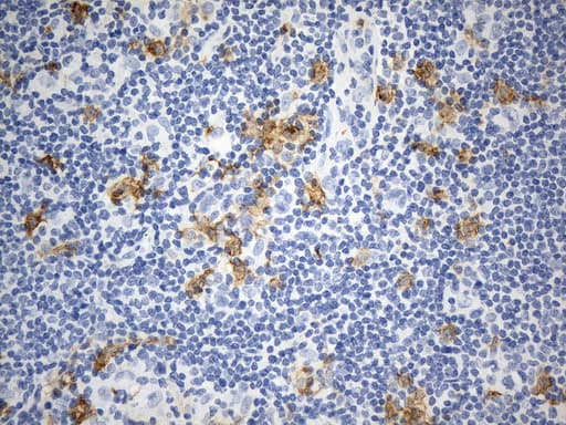 ANPEP / CD13 Antibody (aa668-967, clone UMAB275)