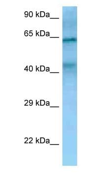 TIMD4 / TIM4 / TIM-4 Antibody (aa64-113)
