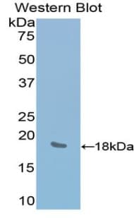 LYAR Antibody (aa270-388, Biotin)
