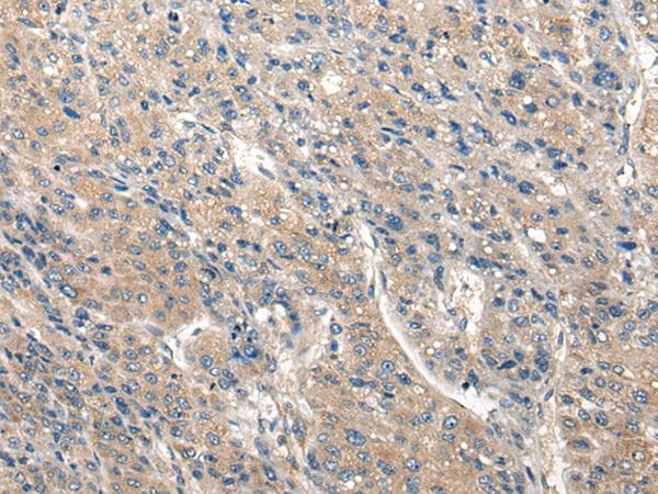 CLIC6 Antibody