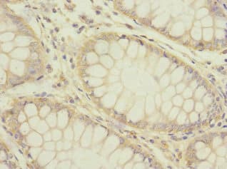 Polyclonal Rabbit anti-Human HTR3B / 5-HT3B Receptor Antibody (IHC, WB)