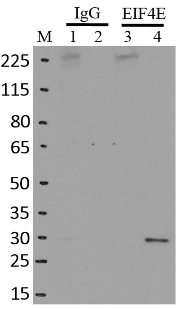 Monoclonal Mouse anti-Human EIF4E Antibody (clone 5D11, IF, WB)