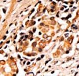 BAD Antibody (phospho-Ser75)