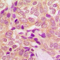 CPT1B Antibody (Internal)