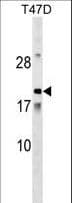 AMTN Antibody (aa13-41)