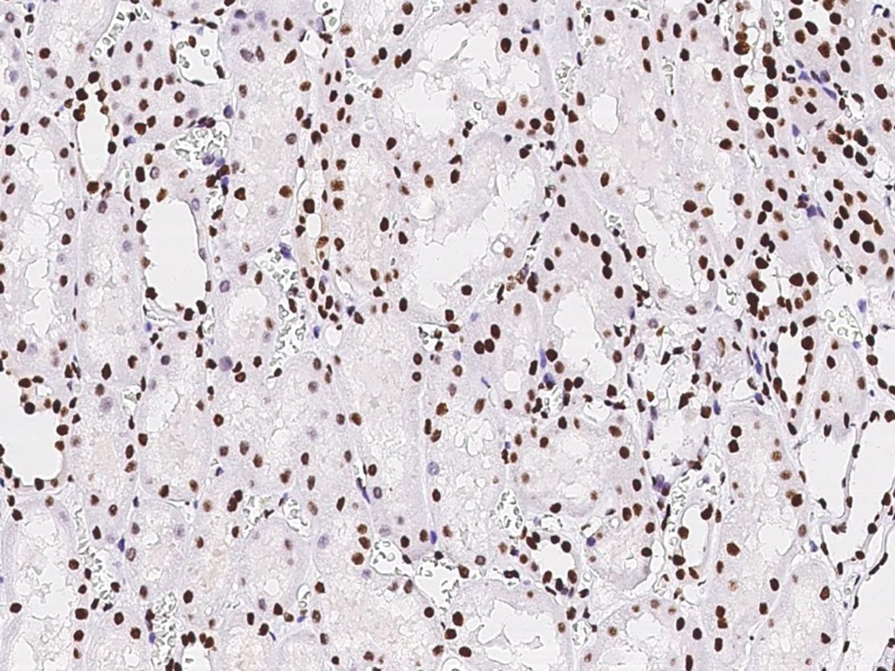 Polyclonal Rabbit anti-Human PAX2 Antibody (Preservative Free, IHC, IF, WB)
