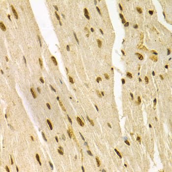 Polyclonal Rabbit anti-Human MAPK3 / ERK1 Antibody (IHC, IF, WB)