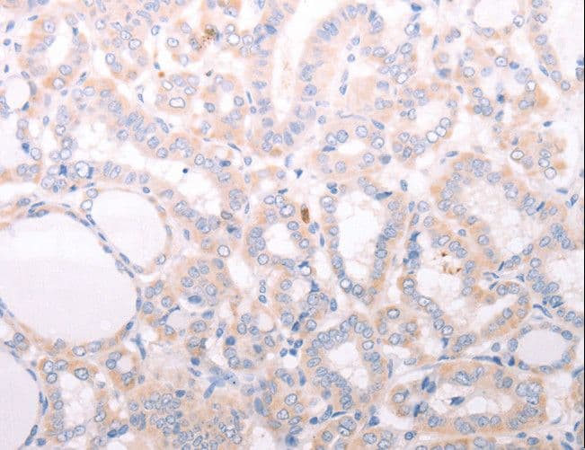 Polyclonal Rabbit anti-Human ANKRA2 / ANKRA Antibody (IHC)