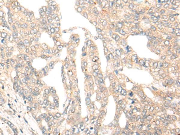 DCP2 Antibody