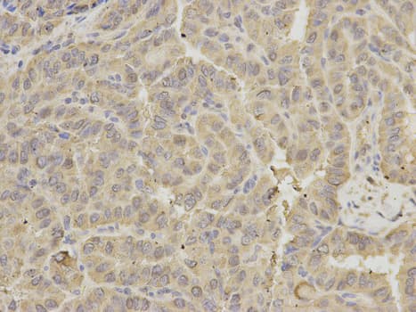 GRIA3 / GLUR3 Antibody