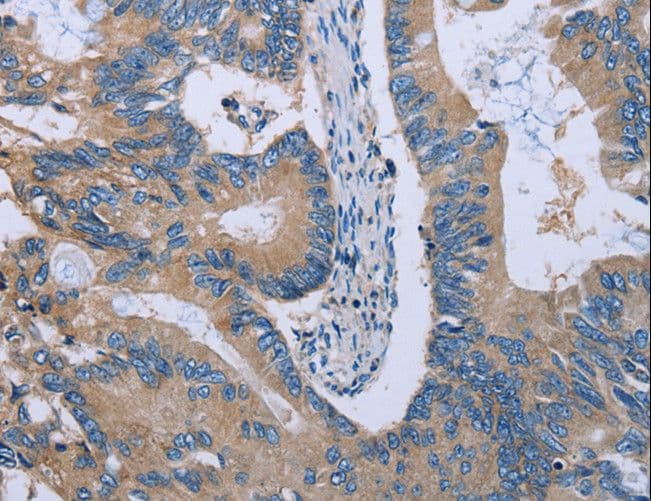 HYAL3 Antibody