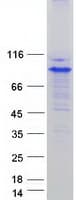 Human SYVN1 / HRD1 Protein (Recombinant Myc-DDK (Flag))