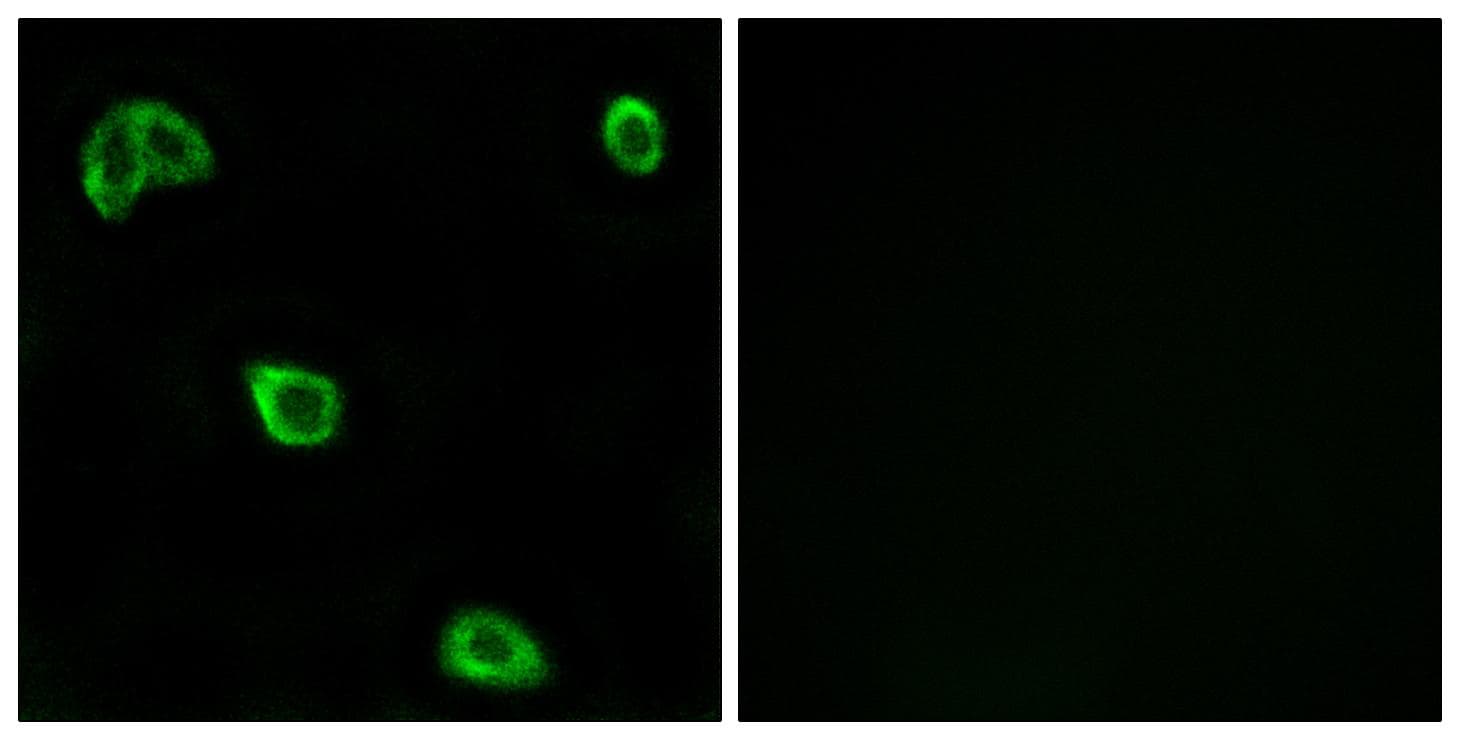 OR10K1+2 Antibody