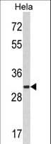 Polyclonal Rabbit anti-Human MARCKS Antibody (aa241-271, WB)