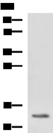 HBZ Antibody