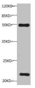 TIMP1 Antibody