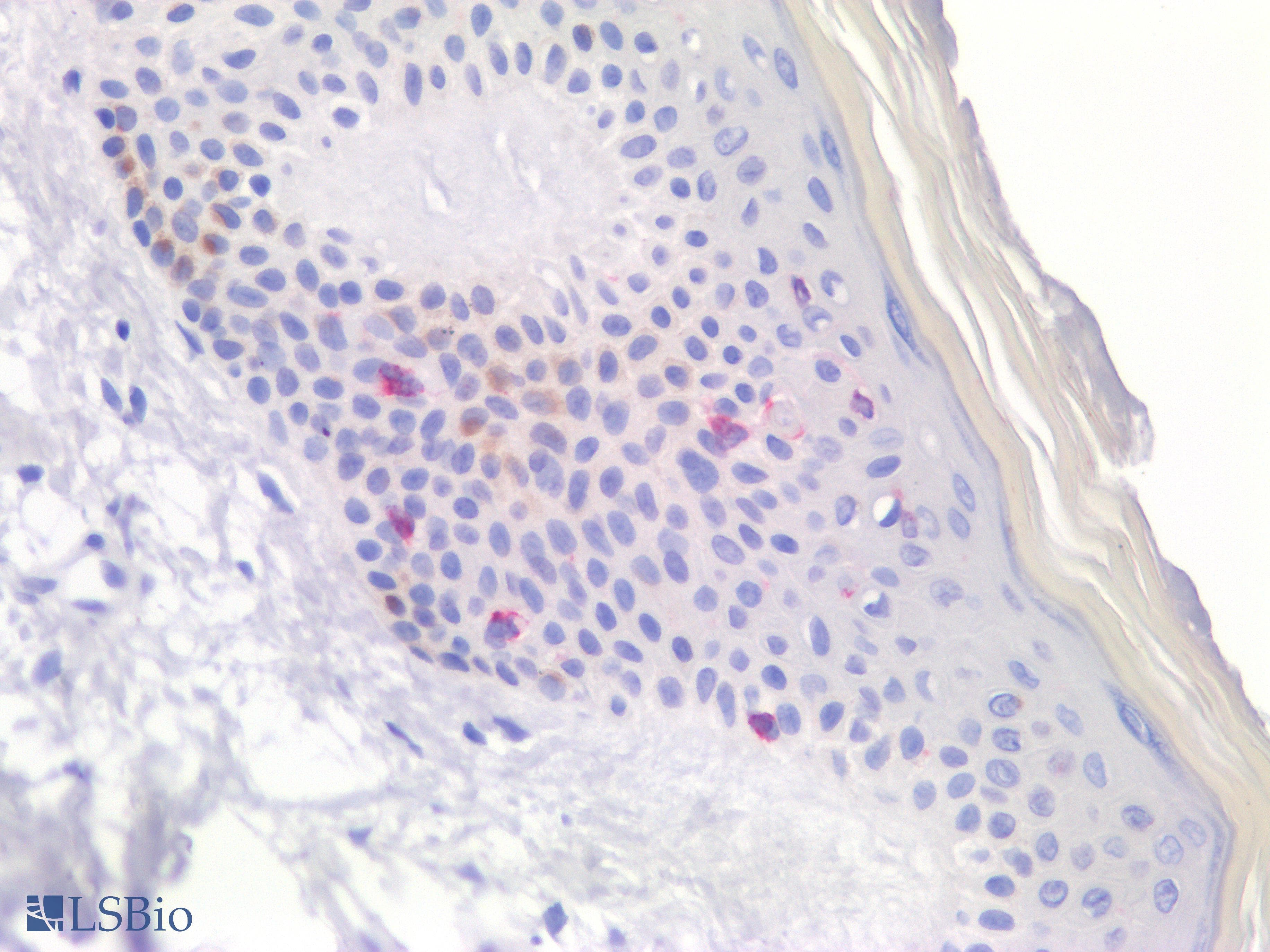 PathPlus™ Monoclonal Mouse anti-Human CD207 / Langerin Antibody (clone 1C5A1, IHC, WB)