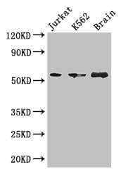 Polyclonal Rabbit anti-Human KIAA0513 Antibody
