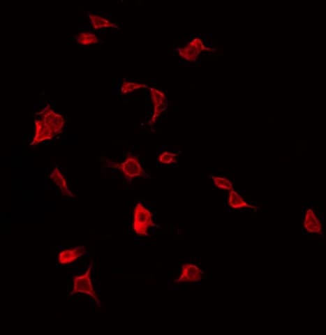 IL1RAPL2 Antibody