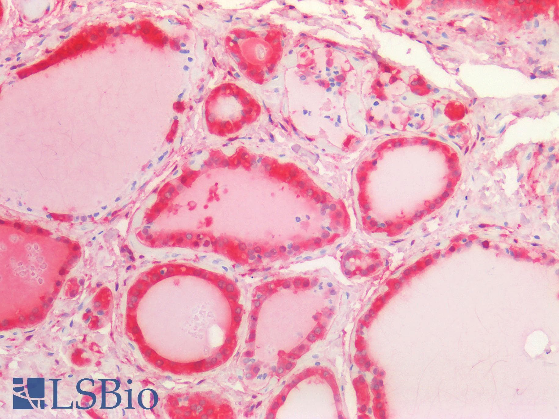 PathPlus™ Monoclonal Mouse anti-Human ALDH1A1 / ALDH1 Antibody (clone 5A11, IHC, WB)