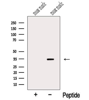 Myozenin / MYOZ1 Antibody