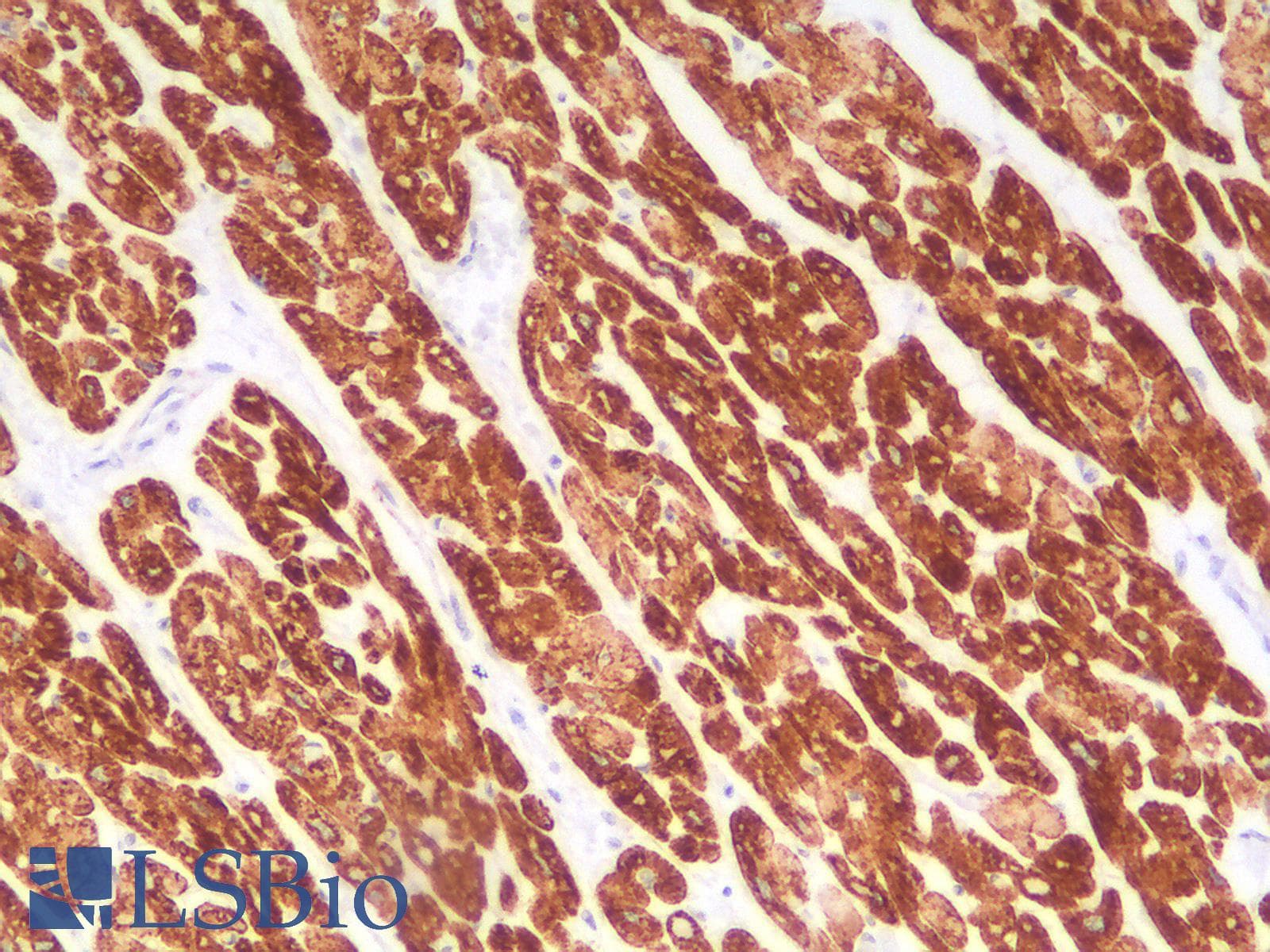 PathPlus™ DES / Desmin Antibody (clone DES/2960R)