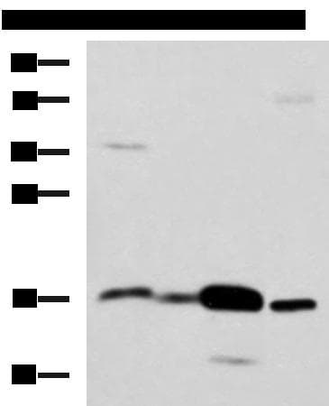 Polyclonal Rabbit anti-Human ZG16 Antibody (IHC, WB)