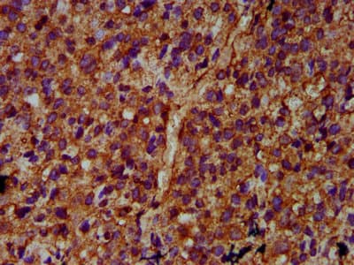 Polyclonal Rabbit anti-Human ULK2 Antibody (IHC, WB)