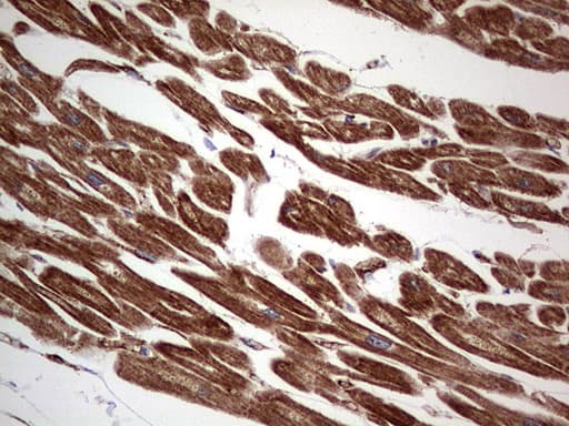 TACC2 Antibody (aa727-1026, clone OTI3C4)