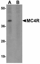 MC4R / Melanocortin 4 Receptor Antibody