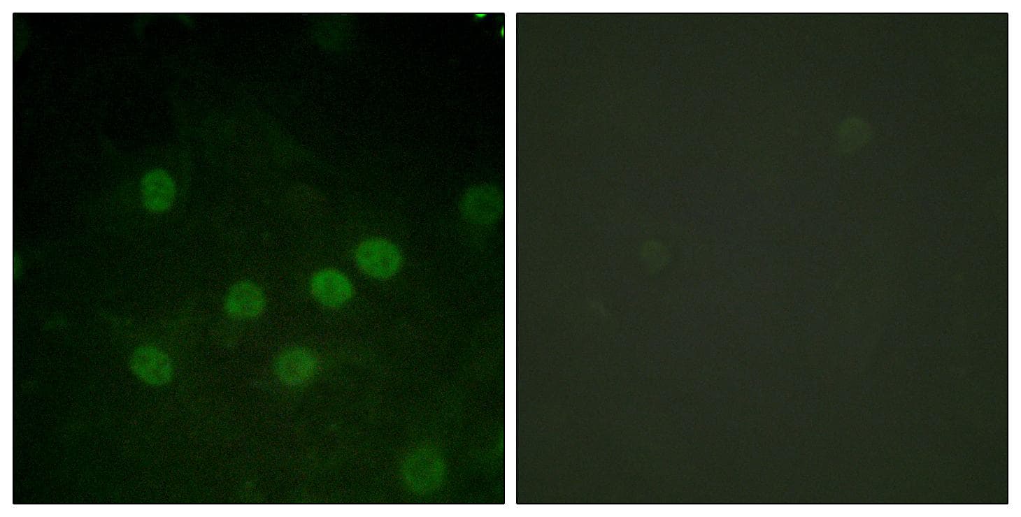 Histone H1 Antibody (phospho-Thr17)