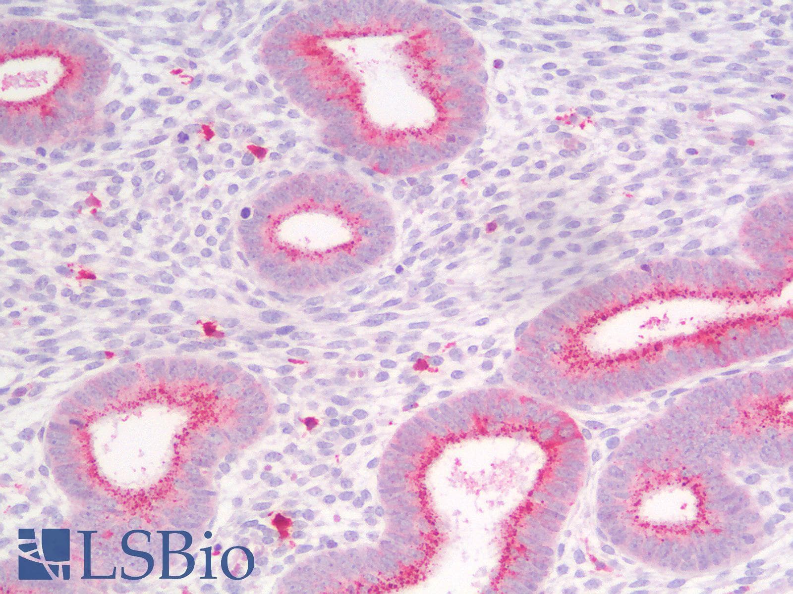 PathPlus™ CDH1 / E Cadherin Antibody