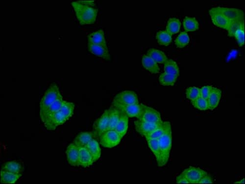 ARHGDIB / D4 GDI Antibody