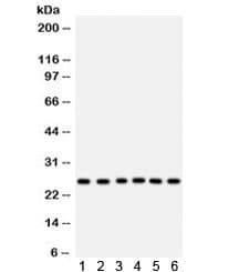 Polyclonal Rabbit anti-Human MtTFA / TFAM Antibody (IHC, WB)