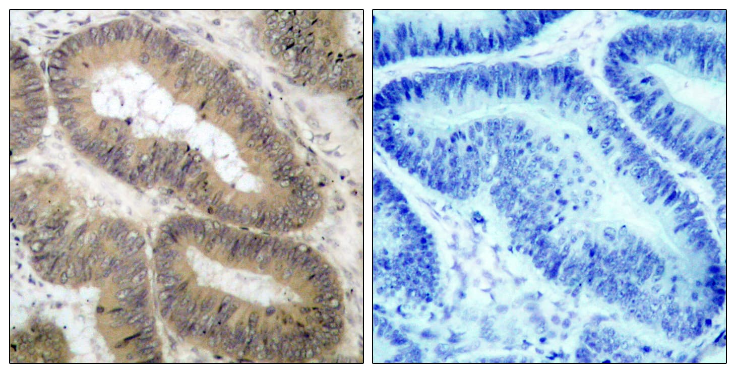 CHUK / IKKA / IKK Alpha Antibody (phospho-Thr23)