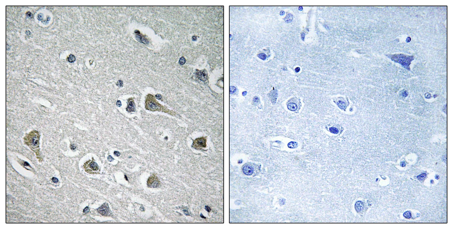 Polyclonal Rabbit anti-Human MYLIP / IDOL Antibody (aa161-210, IHC, WB)